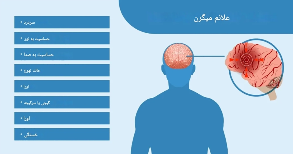  تفاوت بین سکته مغزی و میگرن شدید