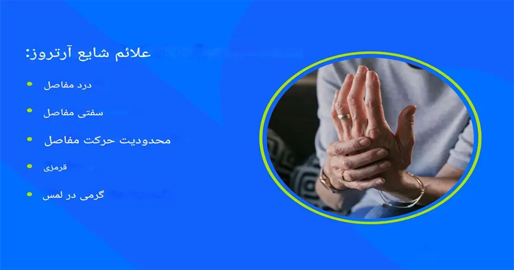 جدیدترین درمان‌های آرتروز