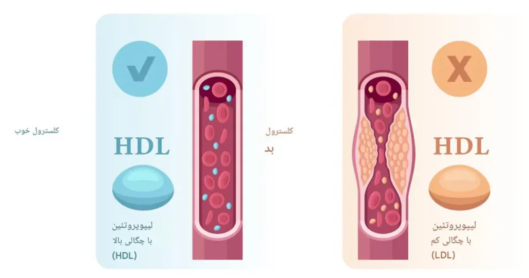 کلسترول خوب و بد چیست؟