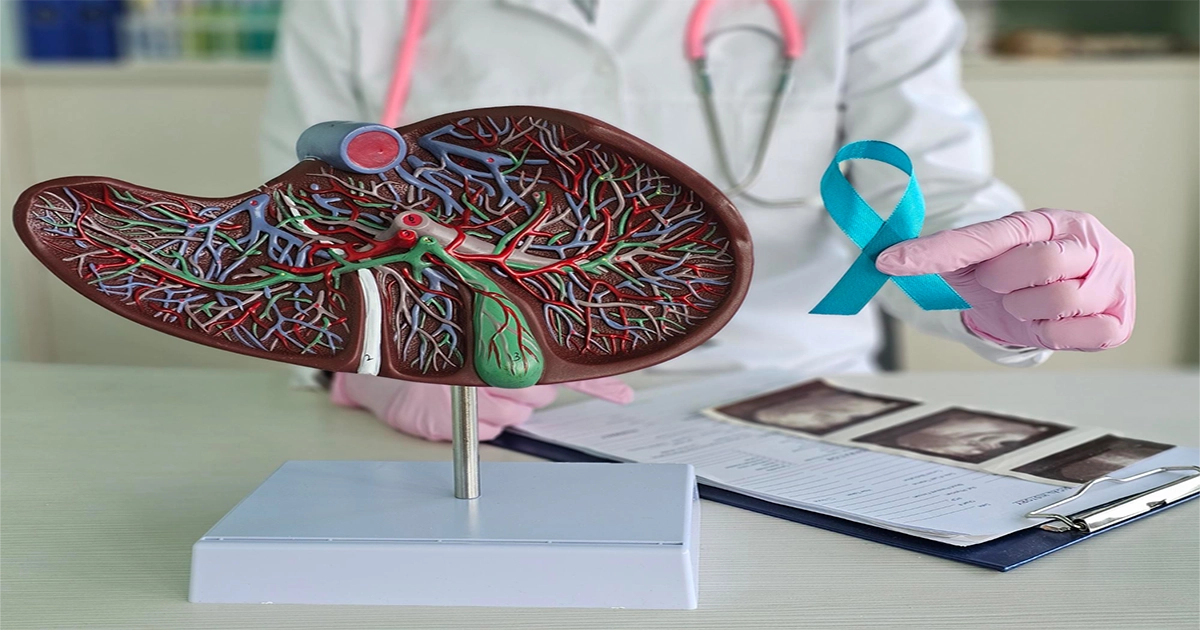 سرطان معده | از علائم تا درمان