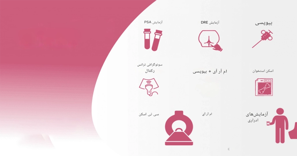 سرطان پروستات: علائم و درمان