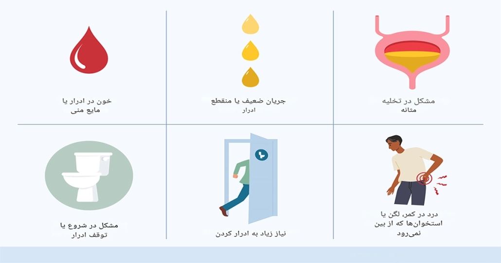 سرطان پروستات: علائم و درمان