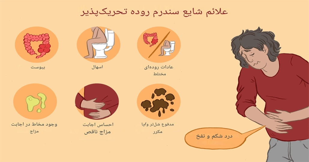 سندروم روده تحریک پذیر (IBS) 3 سندروم روده تحریک پذیر (IBS)