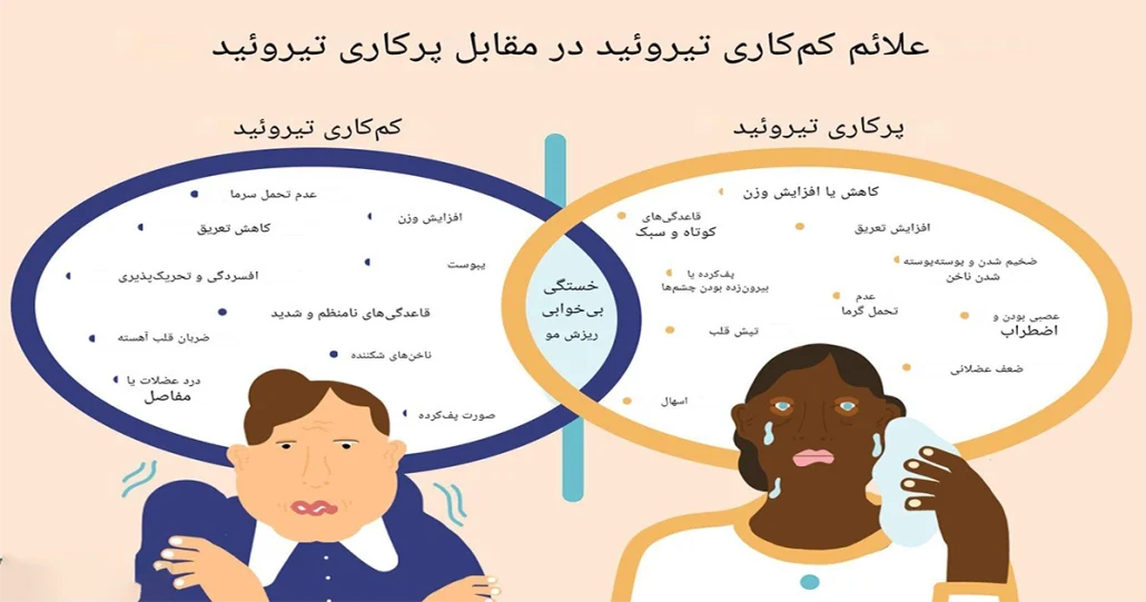 علائم پرکاری تیروئید