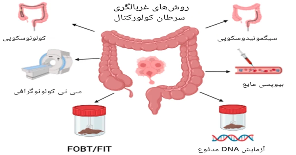 علائم سرطان روده در زنان و مردان 6 علائم سرطان روده در زنان و مردان