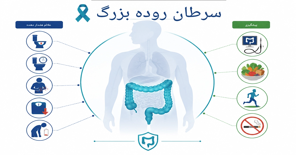 علائم سرطان روده