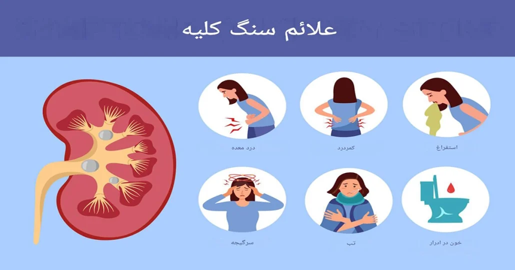 علائم سنگ کلیه، درمان و دفع